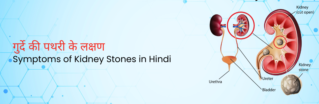 गुर्दे की पथरी के लक्षण